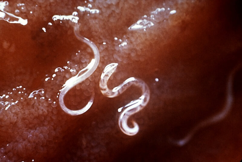 appearance of hookworms intestine